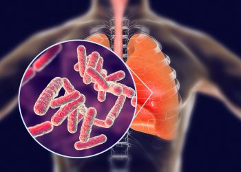 Pandemi, Tüberküloz’a bağlı ölümleri artırabilir!