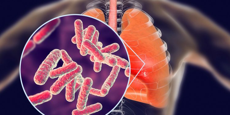 Pandemi, Tüberküloz’a bağlı ölümleri artırabilir!